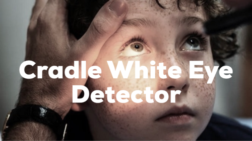 White eye detector